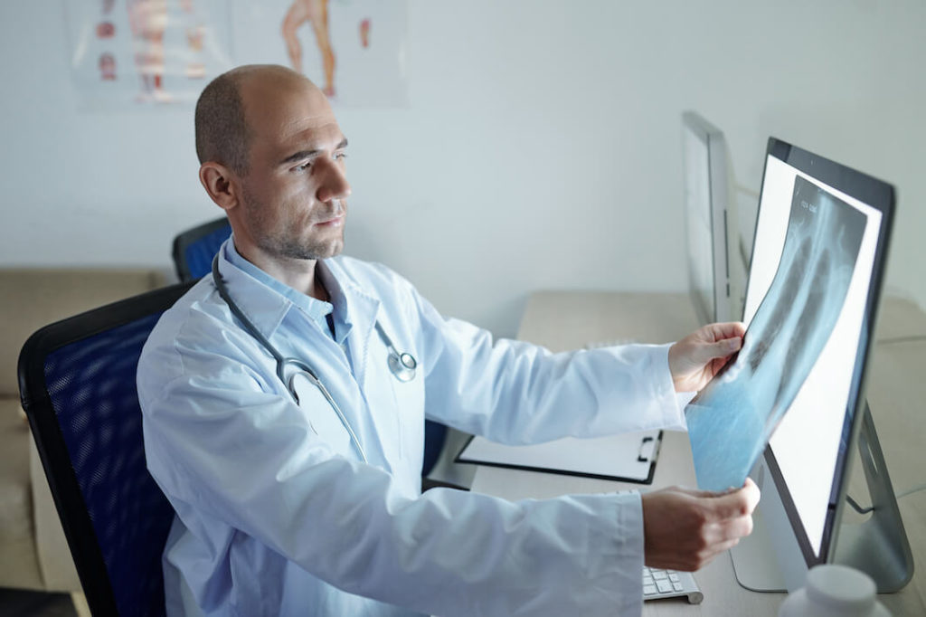 radiologist analyzing x-ray lung cancer pictures of a patient