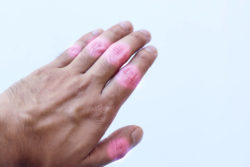 Humira Injection Pen: Medicine Uses and Side Effects