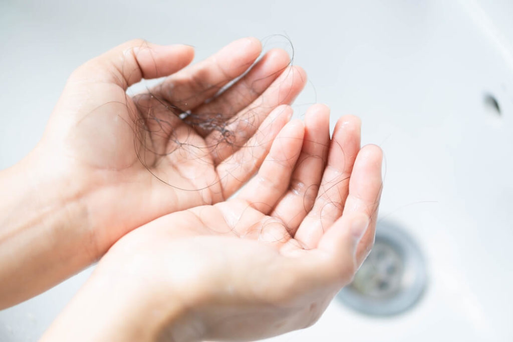 lupus symptoms in women hair loss