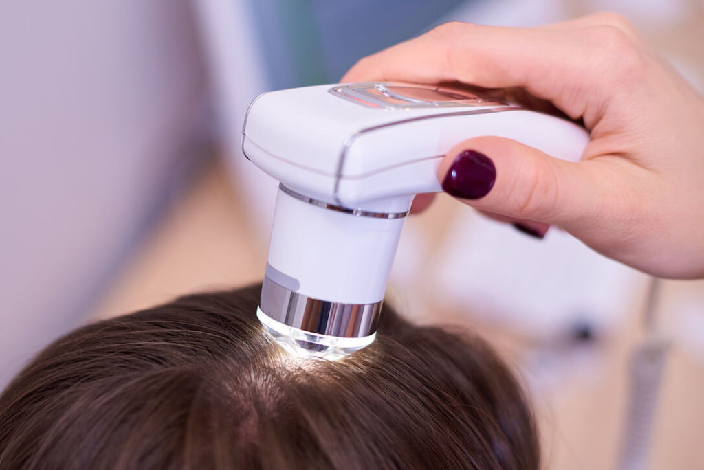 Hair Loss Diagnosis of Causes and Laser Treatment