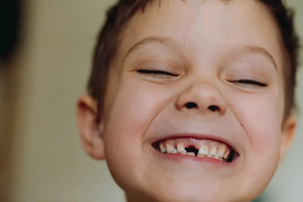 When Baby's Teeth Completely Falls Out - Boy child lost his last baby tooth